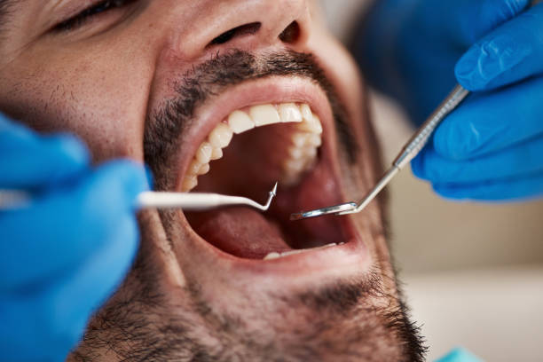 Dental Bonding in Crafton, PA